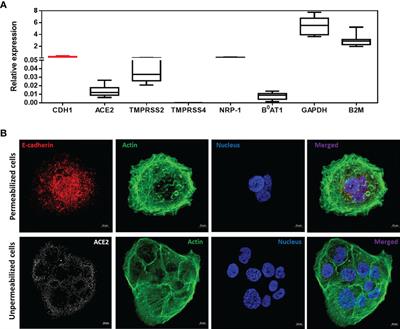 Control of CDH1/E-Cadherin Gene Expression and Release of a Soluble Form of E-Cadherin in SARS-CoV-2 Infected Caco-2 Intestinal Cells: Physiopathological Consequences for the Intestinal Forms of COVID-19